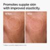 imgi_127_ord-hyaluronic-acid-2pct-b5-hydrating-serum-before-after-elasticity