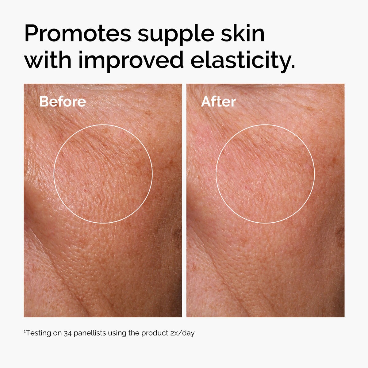 imgi_127_ord-hyaluronic-acid-2pct-b5-hydrating-serum-before-after-elasticity