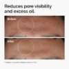 imgi_133_ord-niacinamide-zinc-blemish-serum-before-after-pores